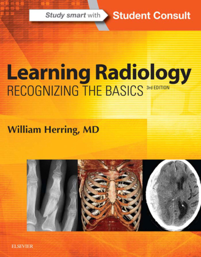 Learning Radiology: Recognizing The Basics / William Herring Fotokopi GO - Tüm Sınavlarda Daha İleriye